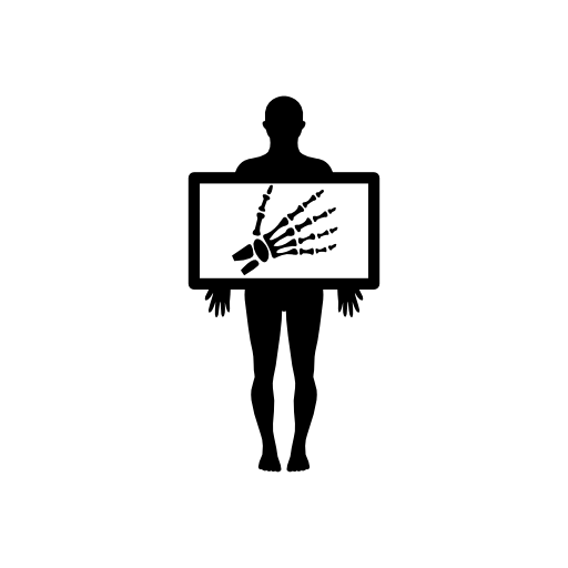 Man holding a hand bones x-ray image